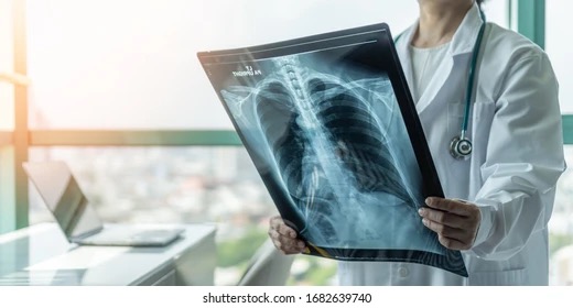 XRAY
